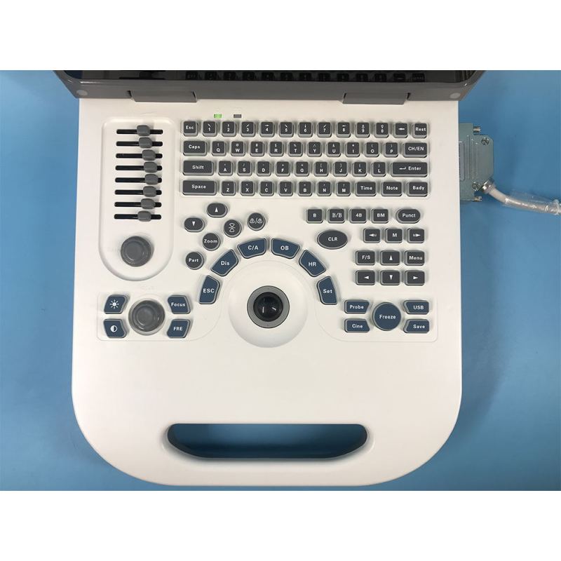 buy ultrasound Portable PC-based Convenient carry function ultrasound machine