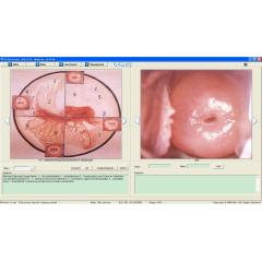 colposcope for gynecology