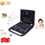 echo doppler 3d medical popular Mindray M9 similar cheapest popular color Doppler ultrasound