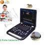 SUN-906A ecografo portatile color doppler ecografo portatile con 3D