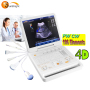Highly recommended laptop CW Vascular color Doppler