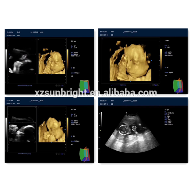 128 elements good quality color doppler ultrasound facotry sale 4D color doppler ultrasound instrument equipment