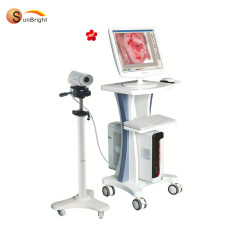 colposcopio para ginecología