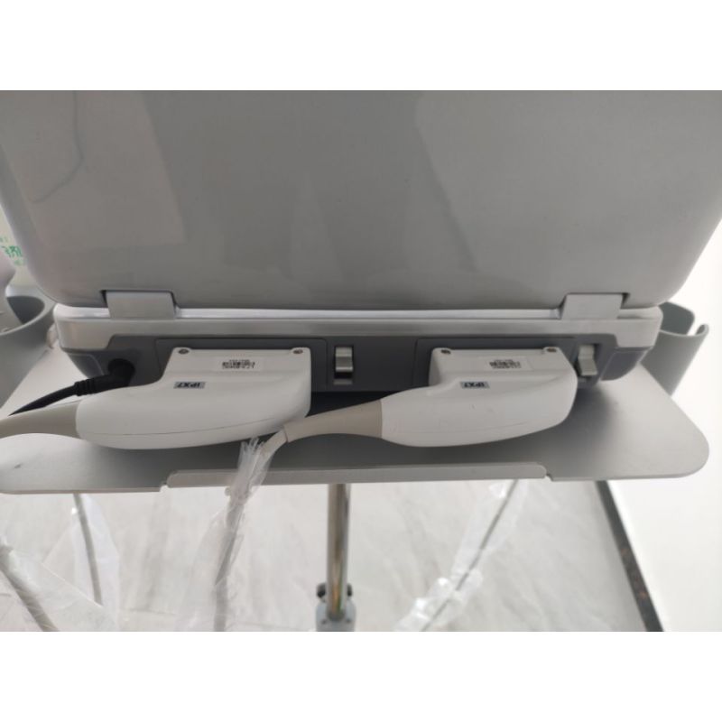 Laptop 3d 4d color doppler digital PC-based ultrasound machine portable ultrasound