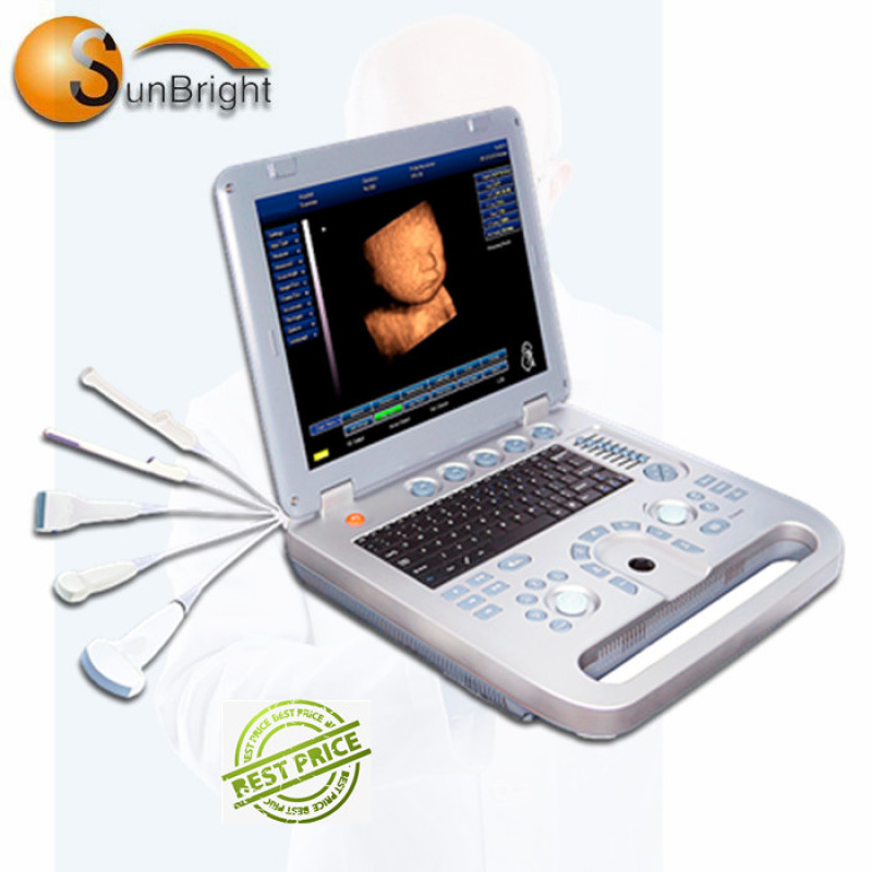 3d 4d 초음파 기계 인간 임신 3D 아기 테스트 저렴한 초음파