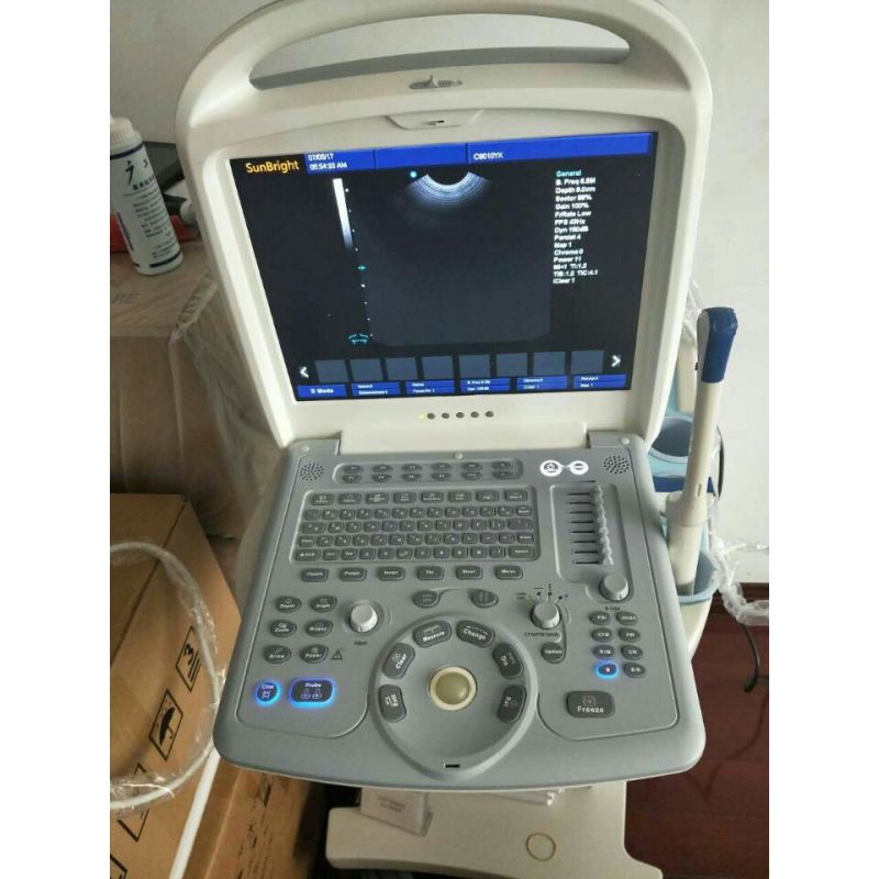 Medical Equipment Fetal Color Doppler portable diagnostic ultrasound machine