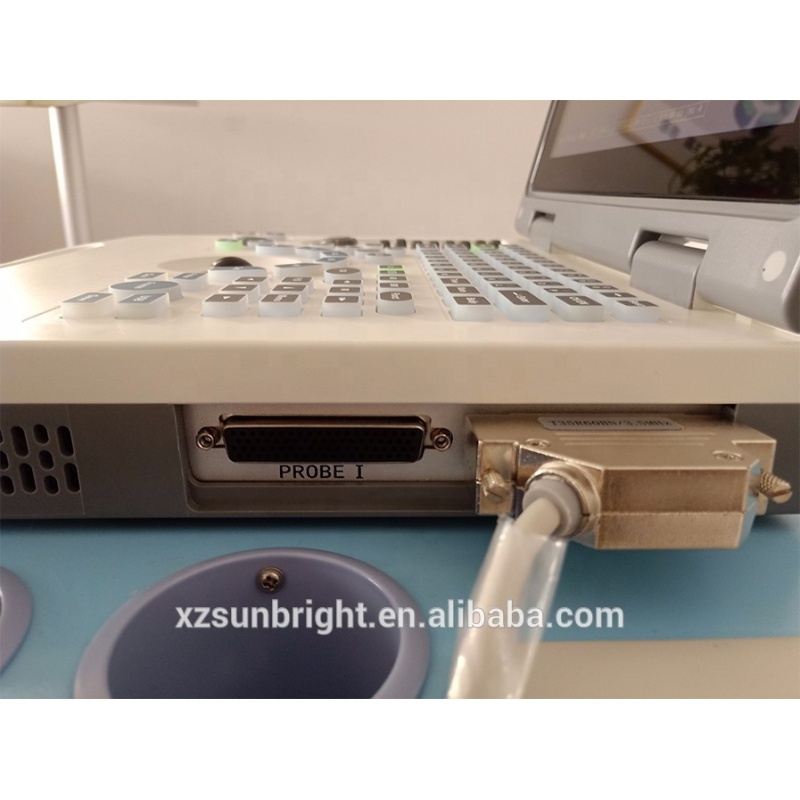 Factory low price cheapest 3D laptop ultrasound machine price