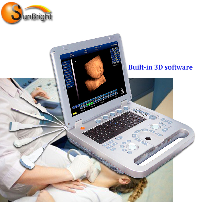 Dispositivo médico del hospital del ordenador portátil de la máquina del escáner del ultrasonido 3d 4d