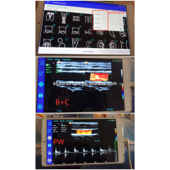 wireless usg ultrasound double head color Doppler probe hand vascular scanner