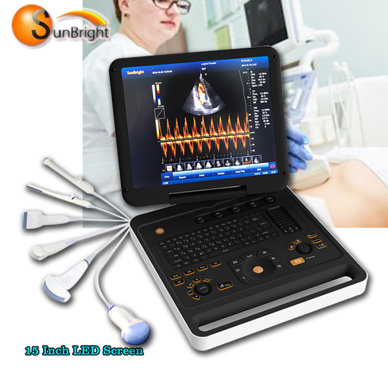 high end medical ultrasound similar with sonoscape portable ultrasound device