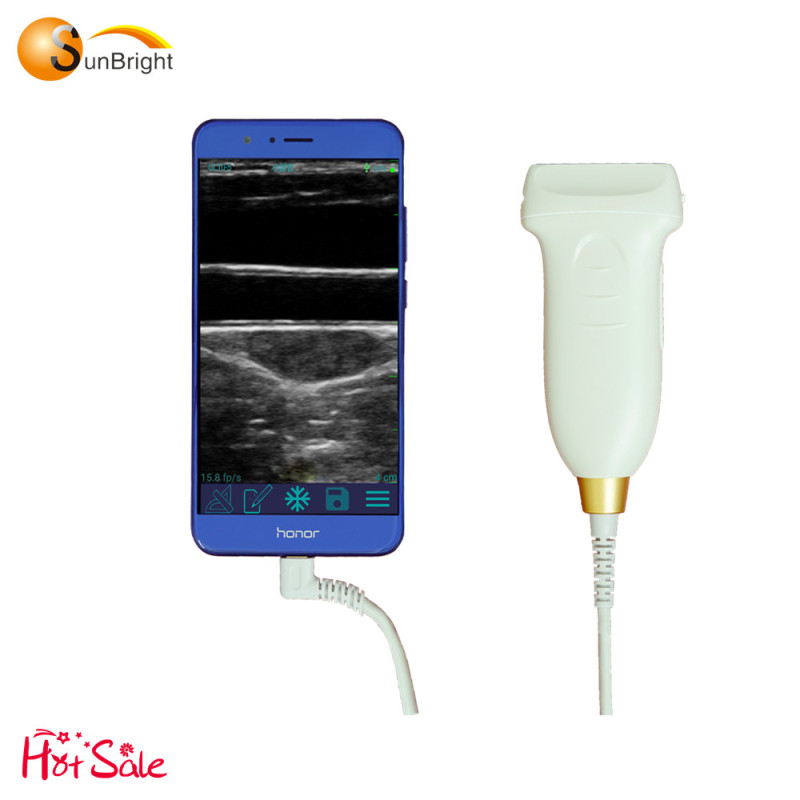 Ecografo a 128 elementi ecografo a sonda lineare USB 2D sunbright per MSK