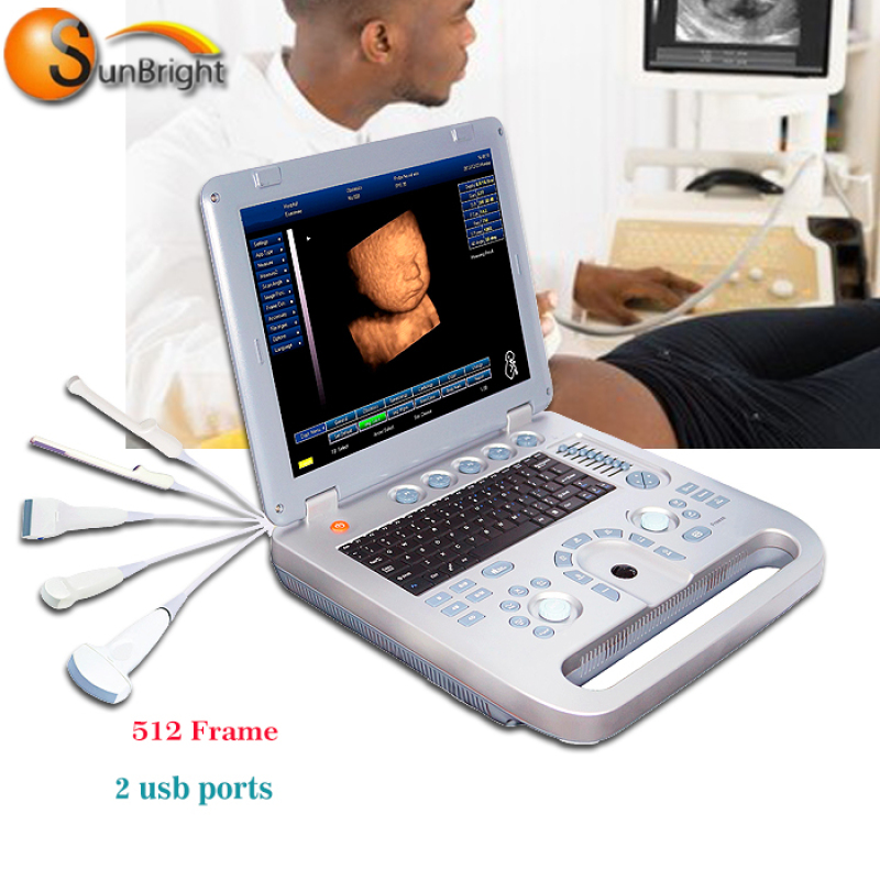 hot sale portable medical  ultrasound scanner machine convex probe