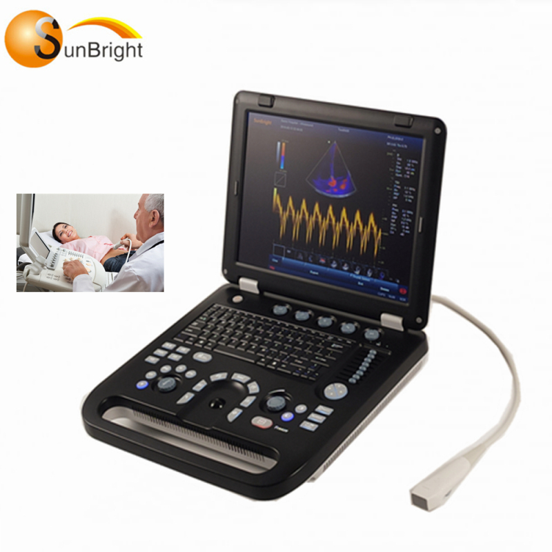 OB diagnosis fetal image portable ultrasound 3D 4D ecografo doppler color