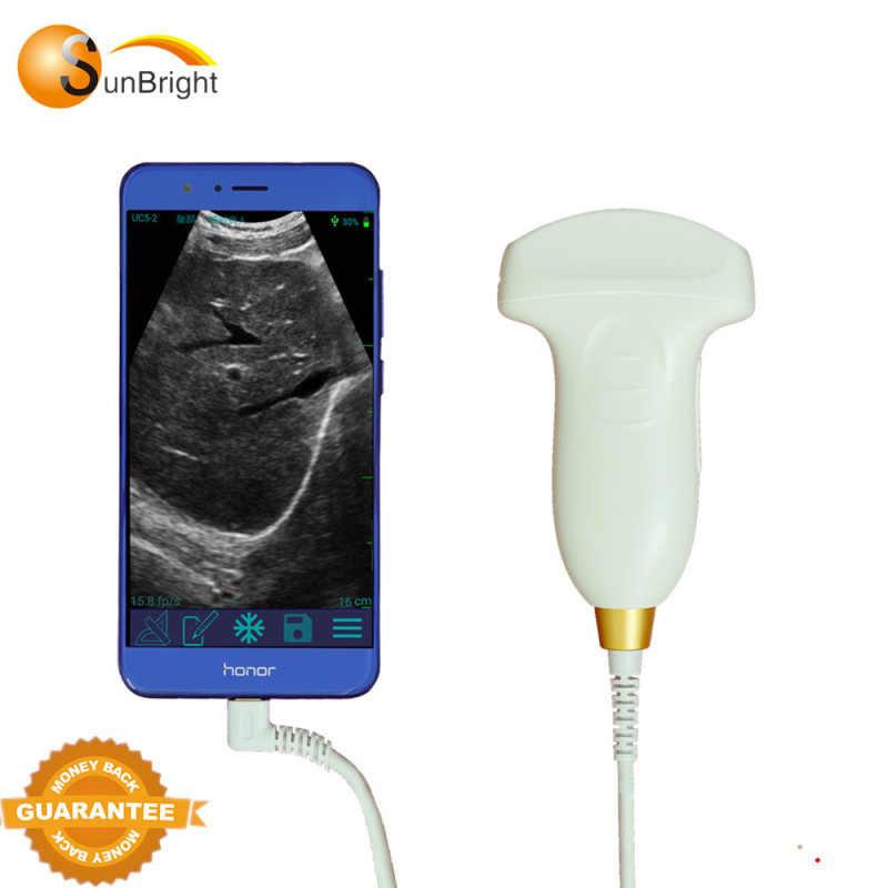 안드로이드 폰용 직접 제조업체 USB 휴대폰 초음파 스캐너