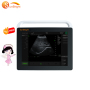 Medical echography portable touch screen ultrasound machine ultrasound machine