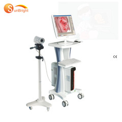 colposcopio para ginecología totalmente digital Sony Camera SUN-200L / colposcopio digital china