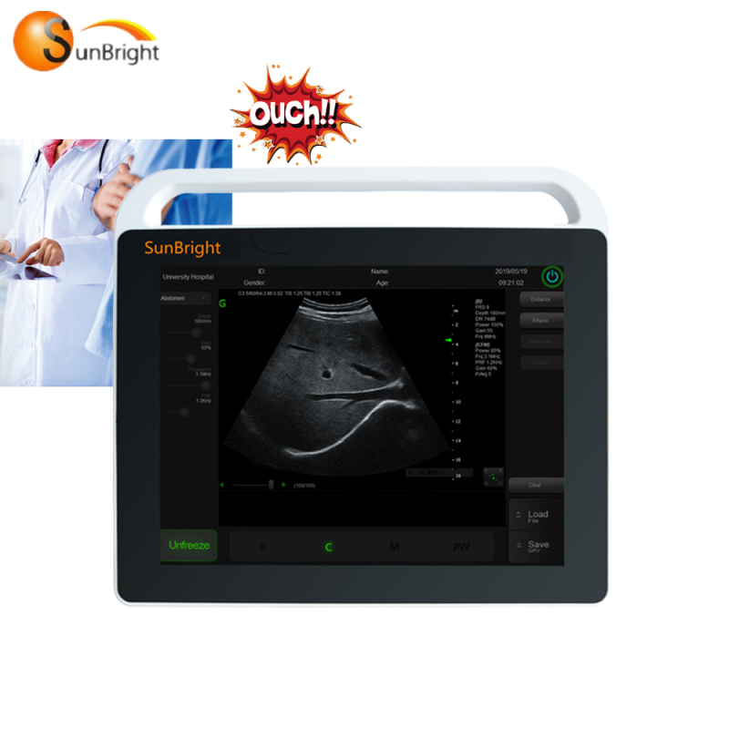 New type 2D SUN-800S touch screen ultrasound device cardiography color doppler 4d ultrasound image medical machine