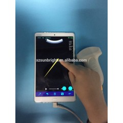 Wireless Ultrasound Probe Echographe Portable USB android ultrasound probe