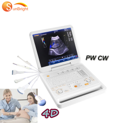Wireless 4D portable laptop ultrasonography machine factory price