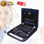 SUN-906C China mejor sistema Doppler color 4D máquina de ultrasonido escáner dispositivo precio escáner portátil 3D