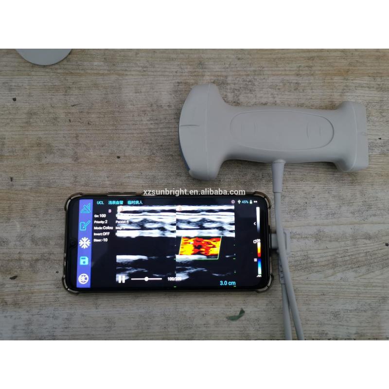 Machine Doppler couleur à double tête, échographie Doppler couleur