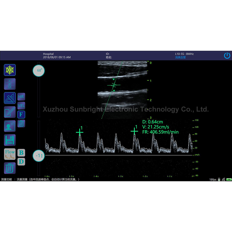 medical high Resolution ecografo portatil mini USB Linear Probe