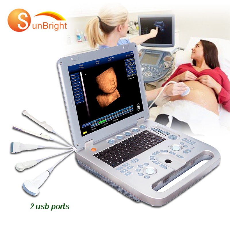 portable 3D cardiac vascular Obstetrics ultrasound pregnancy convex