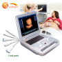 portable 3D cardiac vascular Obstetrics ultrasound pregnancy convex