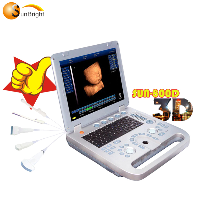 3D 노트북 초음파 스캐너 PC 기반 최고 인기기 SUN 800D