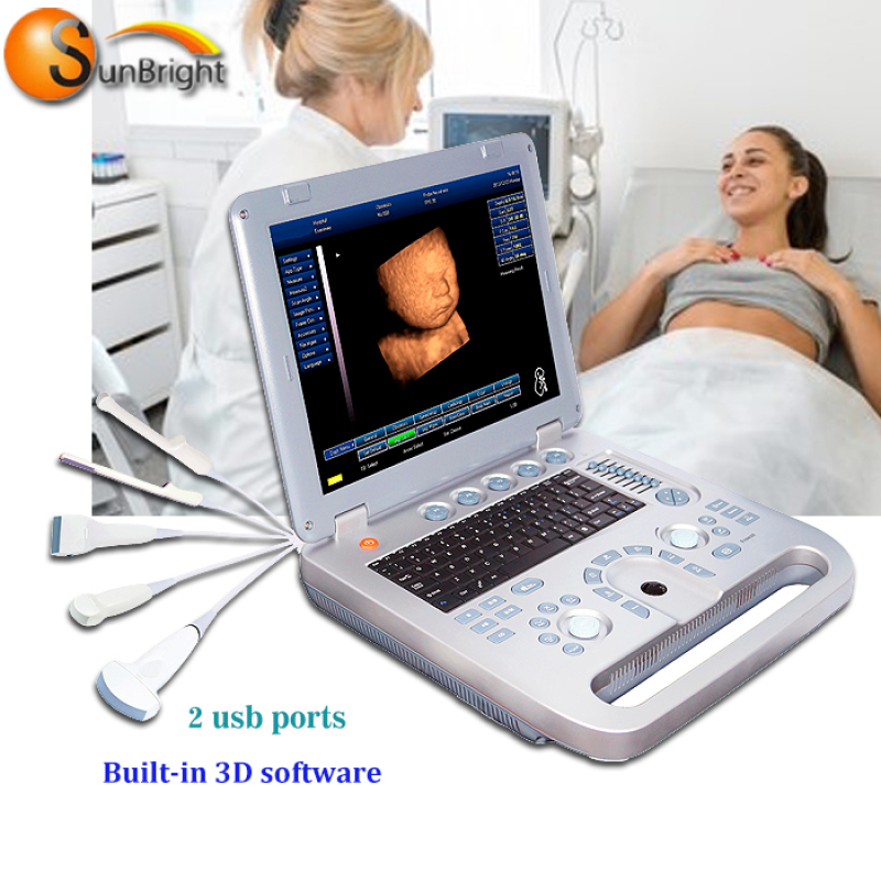 New promotion portable pregnancy Obstetrics Gynecology 3D laptop ultrasound machine
