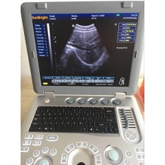 100% return policy laptop 3D equine ultrasound machine SUN-800D with best promotion price