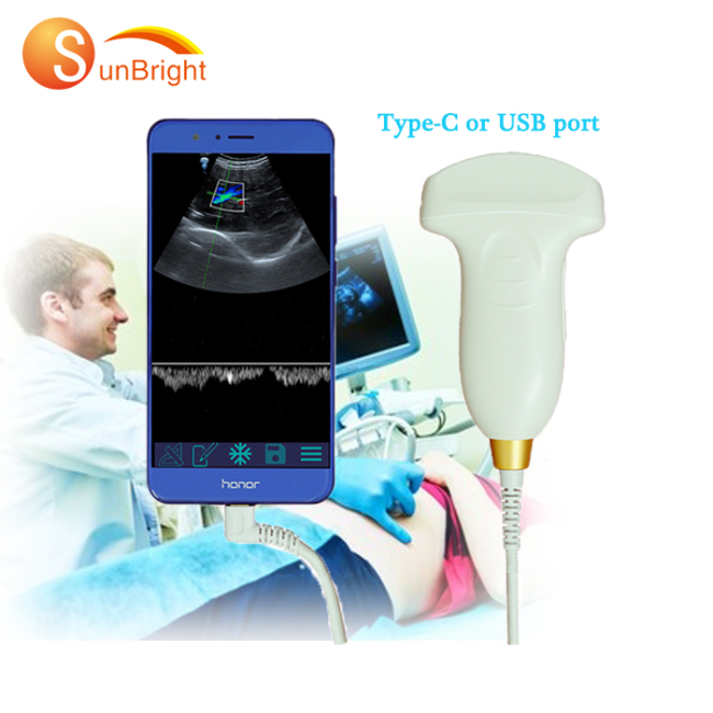 2020 Cheapest Portable USB color doppler convex Scanner with CE