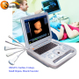 High performacce portable laptop clinical 3D 4D ultrasound machine