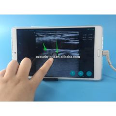 CE Light weight easy to carry 2D ultrasound scanner USB linear probe for sale
