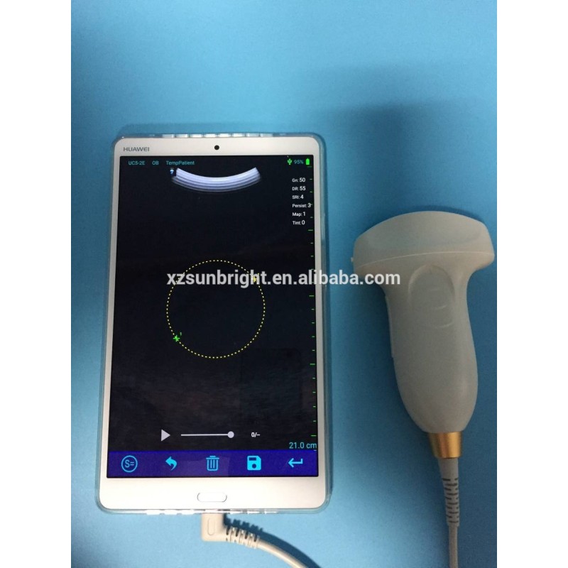 High resolution SUN-P1 medical portable 2D USB probe sonography machine portable ultrasound android