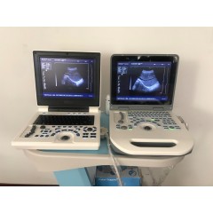 veterinary OB GYN diagnostic System ultrasound 2d portable ultrasound machine