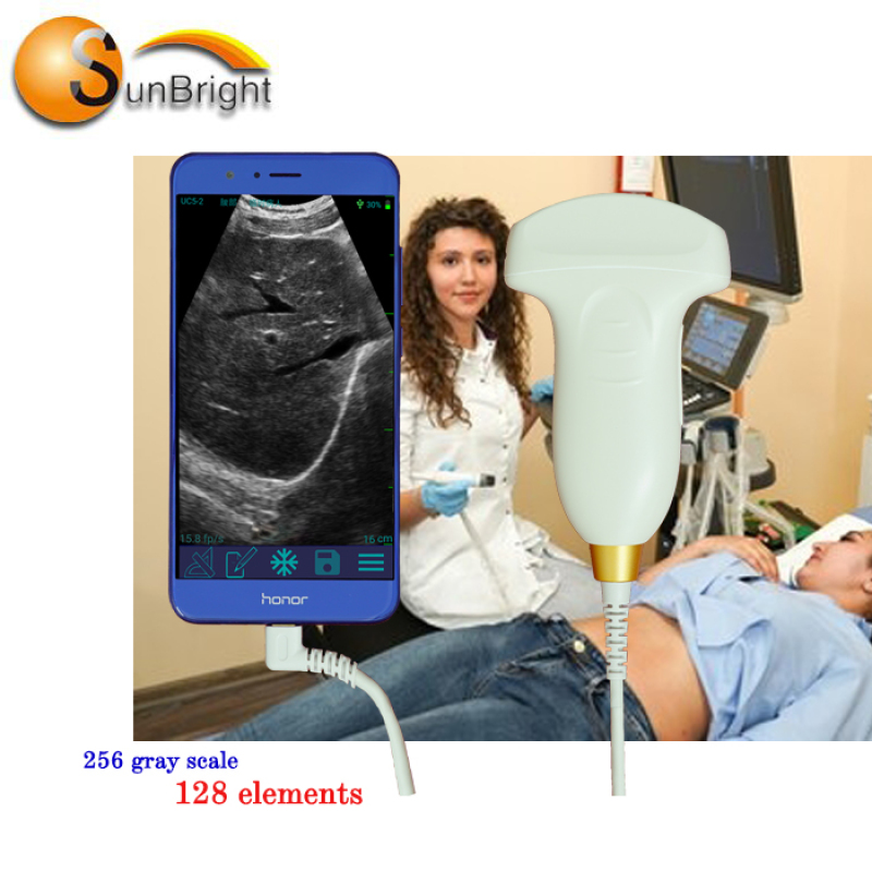 high intensity usb probe medical type color doppler ultrasound usb ultrasound scanner