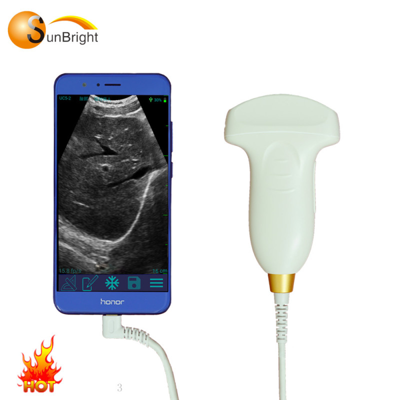 병원 USG 진단 USB 볼록 프로브 장비 SUN-P1