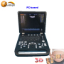 High quality machine ultrasound machine in germany great performance