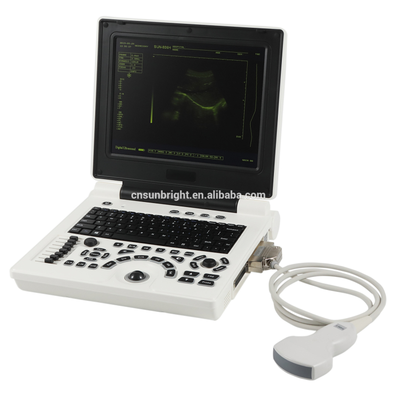 Digital windows system 2D laptop ultrasound machine SUN-806H cheap ultrasound price