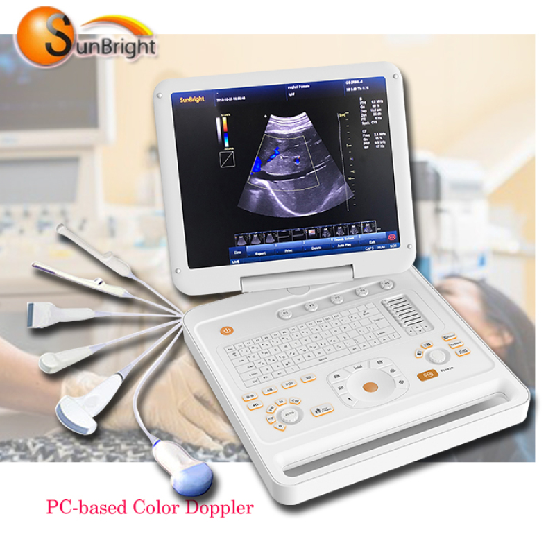 High quality real time 4D color Doppler portable ecografo 4d