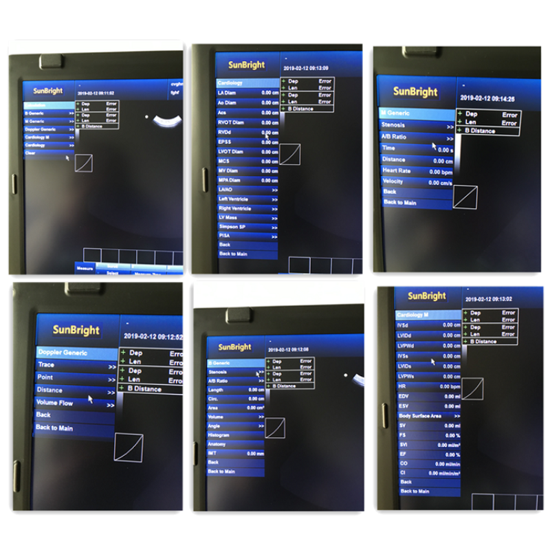 SUN-906A رخيصة كمبيوتر محمول محمول CW PW اللون الماسح الضوئي بالموجات فوق الصوتية دوبلر