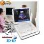 Portable 3d color doppler laptop digital ultrasound Scanner machine with competitive price