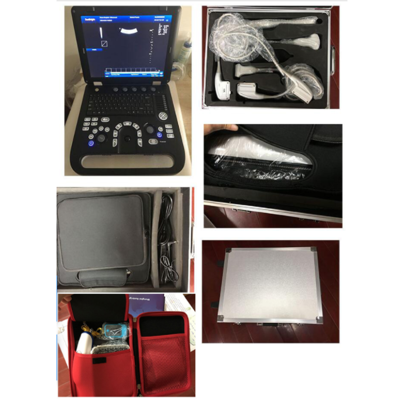 Portable laptop style ecografo portatil color doppler ultrasound scanning medical equipment