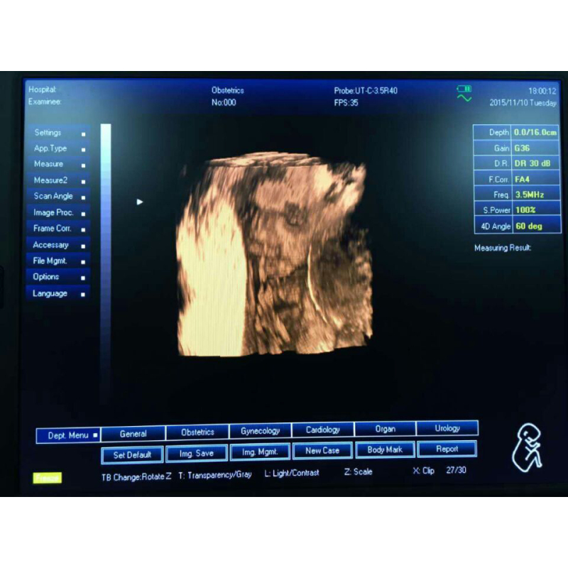 High quality similar ge logiq ultrasound machine 3 probe