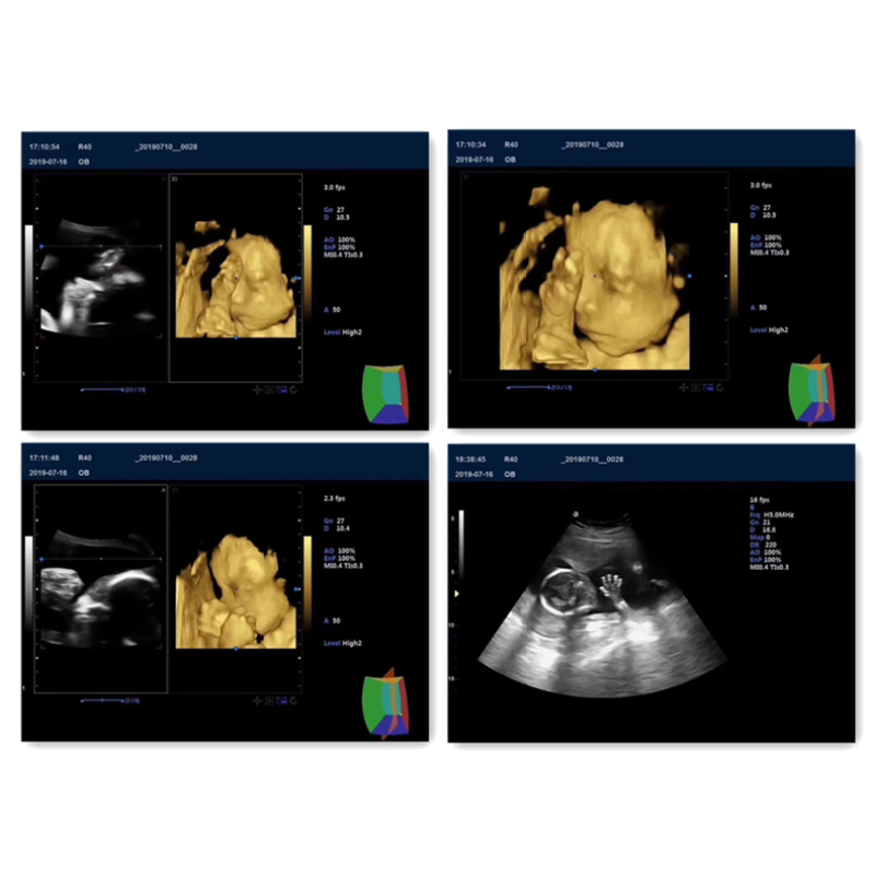 Portable high performance medical 3D 4D CW color doppler ultrasound SUN 906A