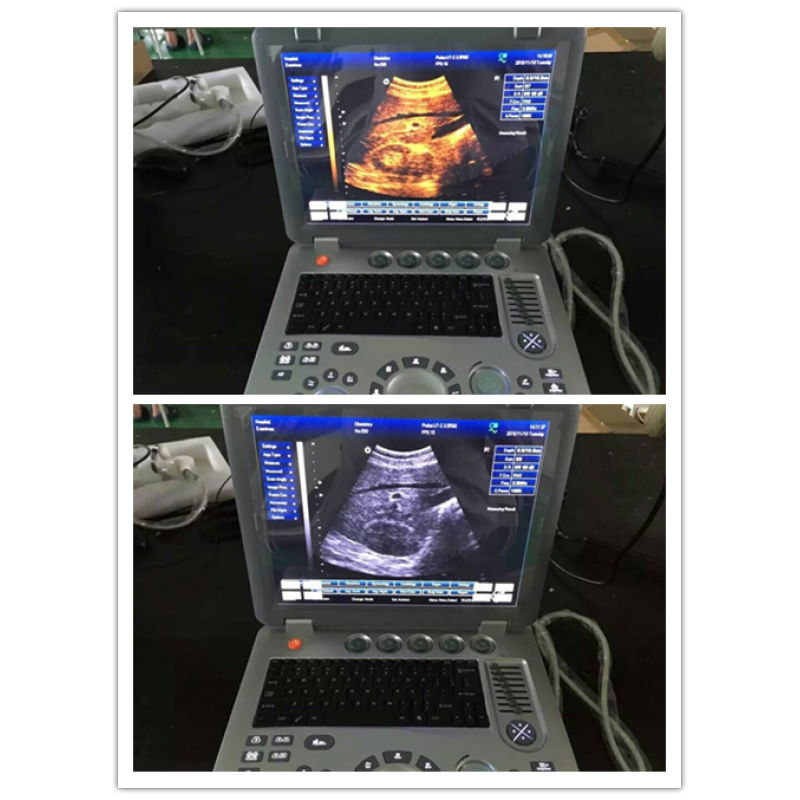 Portable laptop style Medical ecografo 3D 4D ultrasound scanning machine for hospitals