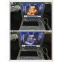 Portable laptop style Medical ecografo 3D 4D ultrasound scanning machine for hospitals