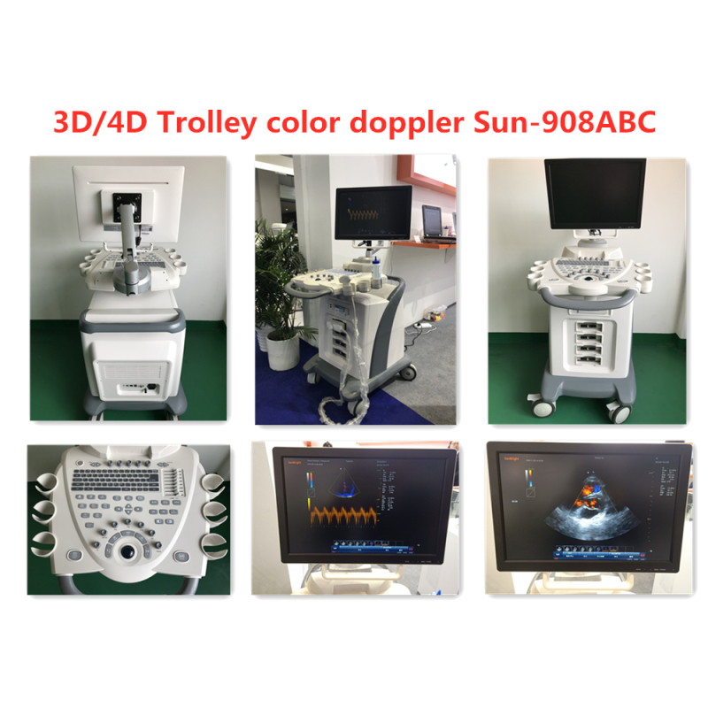 Doppler color doppler ultrasound machine trolley Stationary 4D CW 192 elements ultrasound machine urology scanner