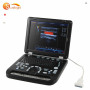 حار البائع جهاز الموجات فوق الصوتية 3D اللون دوبلر كمبيوتر محمول pw الطبية usg الماسح الضوئي